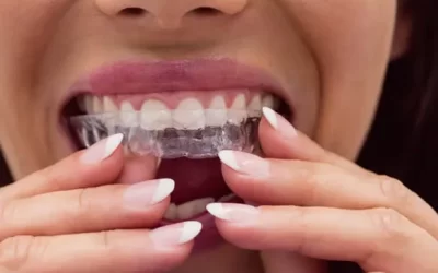 Invisalign Stamford: Clear Aligner Therapy for Discreet Orthodontic Correction